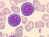 Hematologie Hematologie